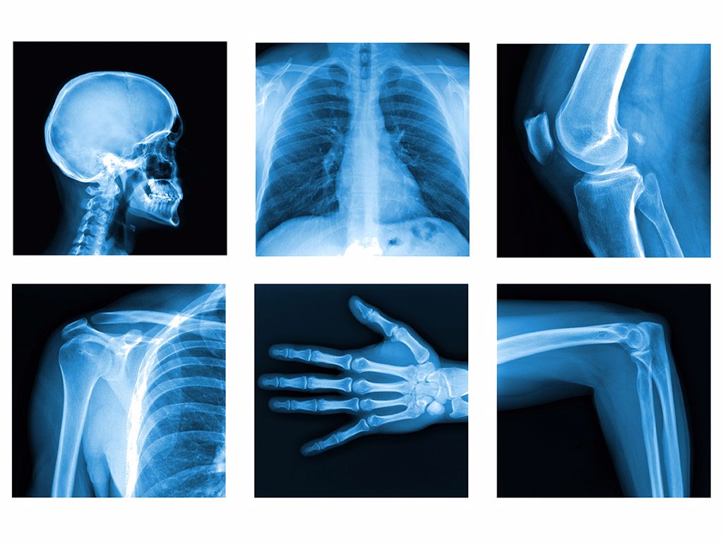 radiology images